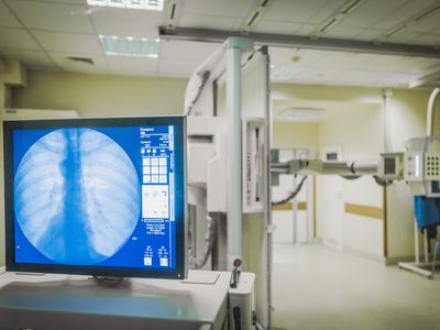 Pracownia rentgenowska z aparatem ogólnodiagnostycznym 
