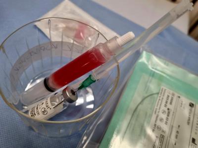 Autologiczna bioaktywna matryca fibrynowa