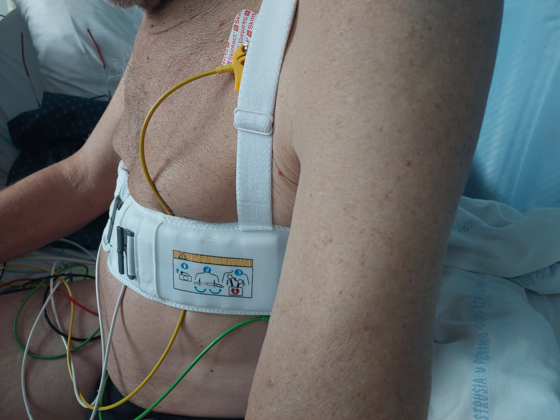 Pacjent z założoną kamizelką defibrylującą